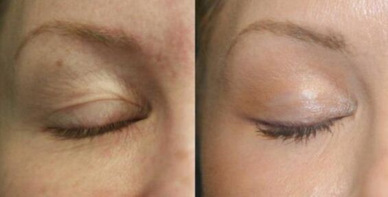 Cuide de áreas perto dos olhos