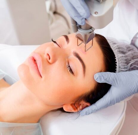 Rejuvenescimento a laser do rosto