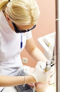 Um médico realiza um procedimento de fototermólise