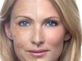 Pigmentação da pele