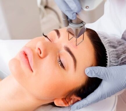 a essência do procedimento de rejuvenescimento da pele facial a laser fracionado
